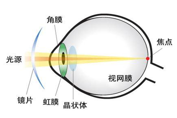散光是怎么造成的 人为什么会发生散光41 / 作者:UFO爱好者 / 帖子ID:88981
