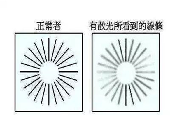 散光是怎么造成的 人为什么会发生散光646 / 作者:UFO爱好者 / 帖子ID:88981