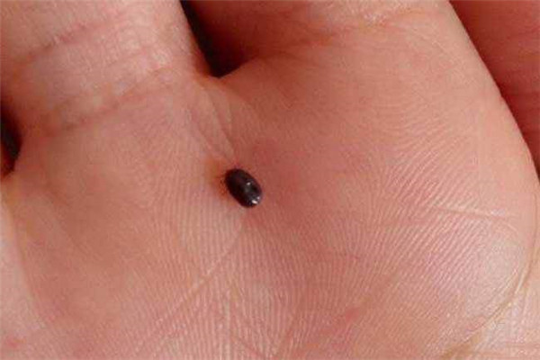 床上有跳蚤怎么去除 被跳蚤咬了怎么办546 / 作者:UFO爱好者 / 帖子ID:87940