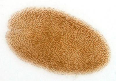 扁虫多可怕 数量庞大寄生人体会影响健康0 / 作者:UFO爱好者 / 帖子ID:87563