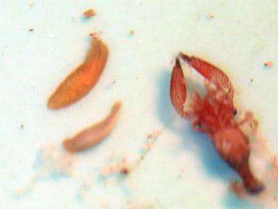 扁虫多可怕 数量庞大寄生人体会影响健康216 / 作者:UFO爱好者 / 帖子ID:87563