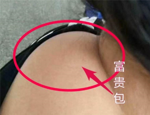 富贵包长什么位置 富贵包对人体危害有哪些402 / 作者:UFO爱好者 / 帖子ID:87323
