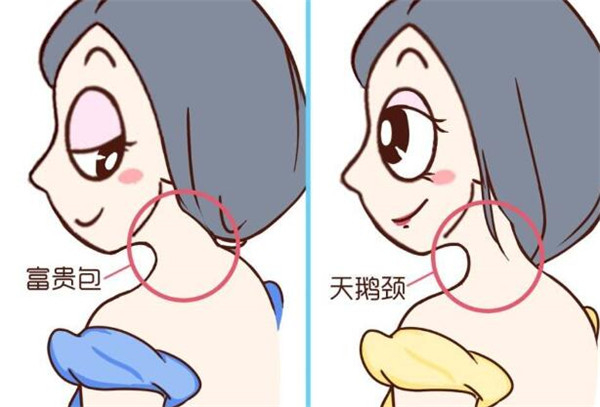 富贵包长什么位置 富贵包对人体危害有哪些15 / 作者:UFO爱好者 / 帖子ID:87323