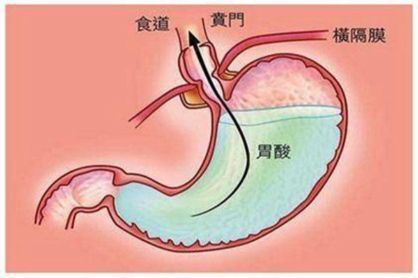 胃液为什么是酸性的?维持肠胃无菌环境(激活蛋白酶)90 / 作者:UFO爱好者 / 帖子ID:83443