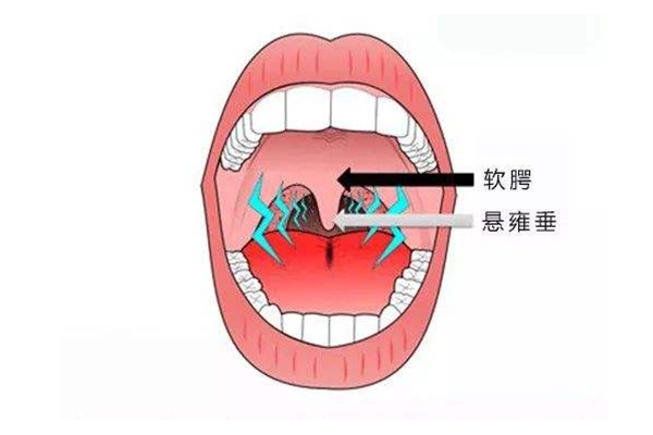 人的小舌有什么用?防止食物和液体倒流鼻腔(食道的小门)681 / 作者:UFO爱好者 / 帖子ID:83289