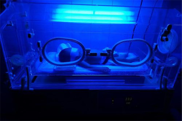 照蓝光变黑后怎么恢复 新生儿蓝光治疗的护理72 / 作者:UFO爱好者 / 帖子ID:89687