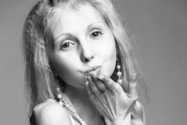 世界上最瘦零脂肪女孩:轻如幼儿仅40斤(皮肤干瘪像骷髅)295 / 作者:UFO爱好者 / 帖子ID:94811