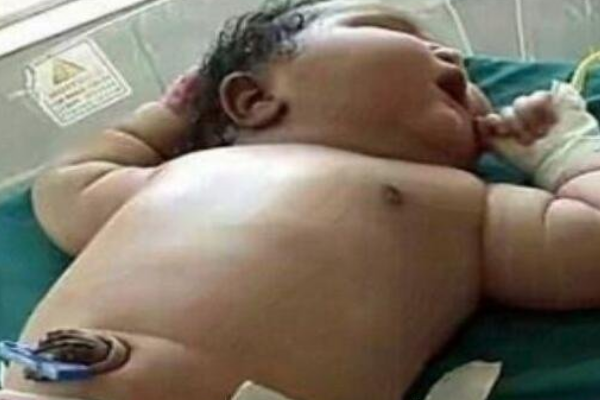 世界上最重的女婴:出生体重达13.6斤(等于普通宝宝2倍)274 / 作者:UFO爱好者 / 帖子ID:94806