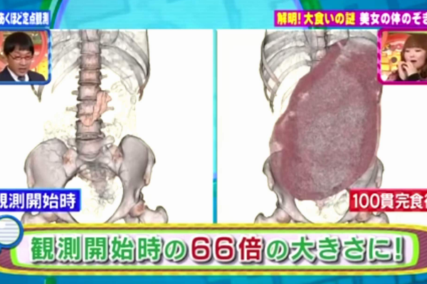 世界上最能吃的人:木下佑哗(胃是正常人的66倍)493 / 作者:UFO爱好者 / 帖子ID:94799