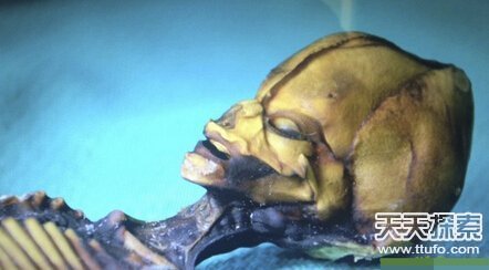 外星人存在?37张照片曝真相867 / 作者:UFO爱好者 / 帖子ID:74147 外星人存在?37张照片曝真相867 / 作者:UFO爱好者 / 帖子ID:74147