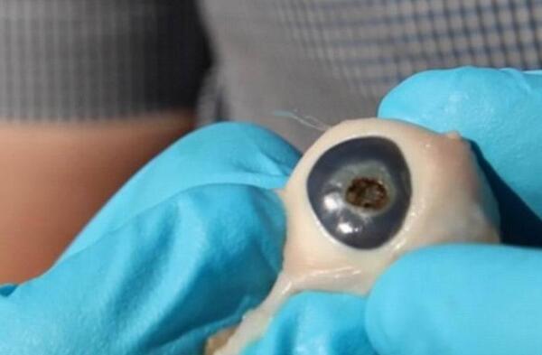 天文望远镜看太阳吓人，眼睛可能会瞎/防止小朋友观看232 / 作者:UFO爱好者 / 帖子ID:81629