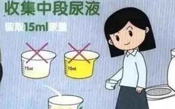 尿能喝吗?有毒吗，不能喝/有微毒（喝尿对身体不好）141 / 作者:UFO爱好者 / 帖子ID:90236