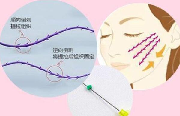 大v线提拉危害，发胀并发症/面部凹陷后遗症（去正规机构危害小）621 / 作者:UFO爱好者 / 帖子ID:90121