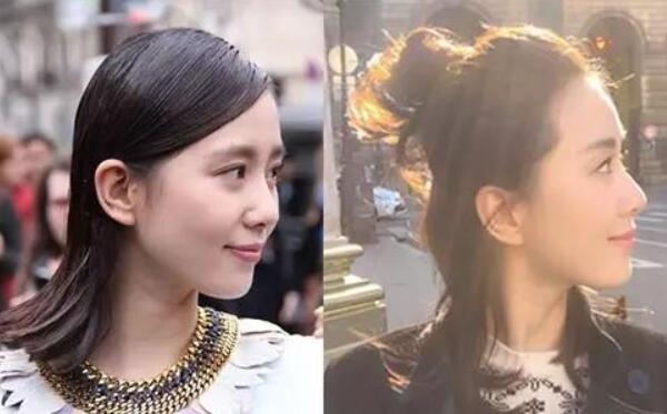 扁平后脑勺的危害，对人体无害/影响美观（婴儿可矫正）669 / 作者:UFO爱好者 / 帖子ID:89535