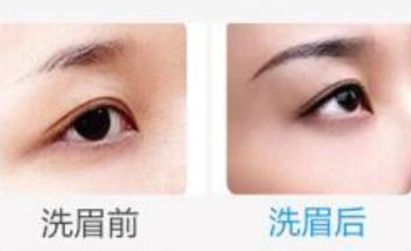 洗眉会痛吗，洗眉后多久可以沾水（手术小3天内不要沾水）820 / 作者:UFO爱好者 / 帖子ID:87649