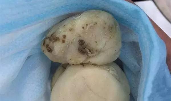 土豆发霉打了皮能吃吗，不能吃（吃了会中毒）554 / 作者:UFO爱好者 / 帖子ID:83354