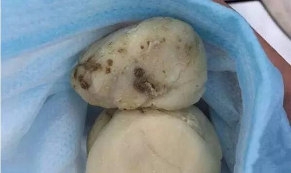 土豆有霉味了能吃吗，有毒素不能吃（吃了会呕吐、腹泻）265 / 作者:UFO爱好者 / 帖子ID:82811