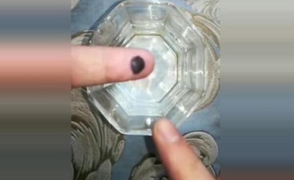 手上血泡怎么处理，小血泡吃消炎药（大血泡用针挑破）423 / 作者:UFO爱好者 / 帖子ID:82277