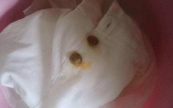 衣服上的铁锈怎么去除，用柠檬汁、酸奶、草酸清洗663 / 作者:UFO爱好者 / 帖子ID:81312