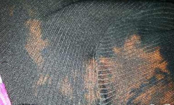 衣服上的铁锈怎么去除，用柠檬汁、酸奶、草酸清洗290 / 作者:UFO爱好者 / 帖子ID:81312