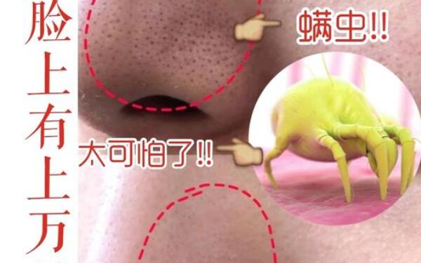 螨虫咬的包是啥样子，红疙瘩像丘疹（多成片出现很吓人）166 / 作者:UFO爱好者 / 帖子ID:81142