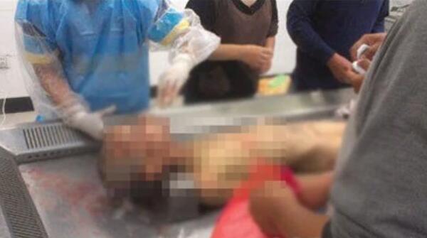 9·20河南挖眼抛尸案结果：9岁男童被挖眼，失血休克而死997 / 作者:UFO爱好者 / 帖子ID:99545
