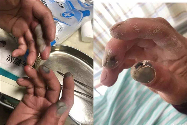 最恐怖的化学元素是什么 它的危害有哪些747 / 作者:UFO爱好者 / 帖子ID:103081