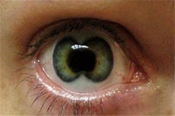 人类5种罕见的瞳孔 其中不少瞳孔看起来非常恐怖775 / 作者:UFO爱好者 / 帖子ID:102329