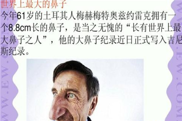 世界上最大鼻子的人是谁 梅赫梅特因为鼻子成为名人821 / 作者:UFO爱好者 / 帖子ID:94430