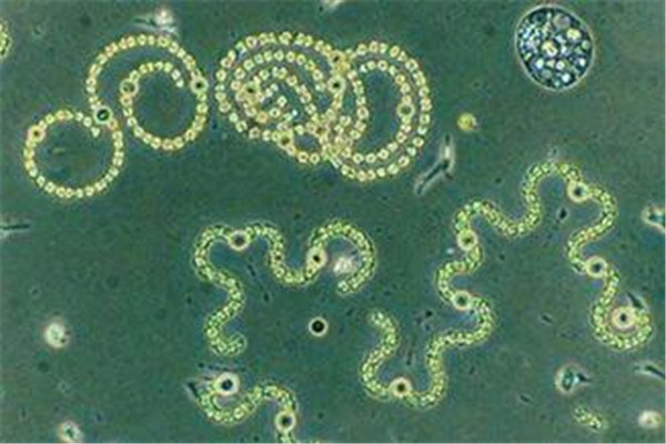 世界上最小的活生物体 古菌微生物（2006年被发现）808 / 作者:UFO爱好者 / 帖子ID:91902