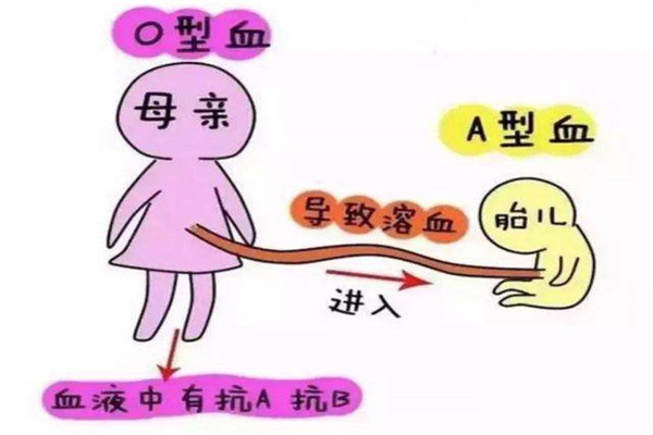 o型血和a型血生的孩子是什么血型 孩子的血型和父亲一致吗259 / 作者:UFO爱好者 / 帖子ID:101255
