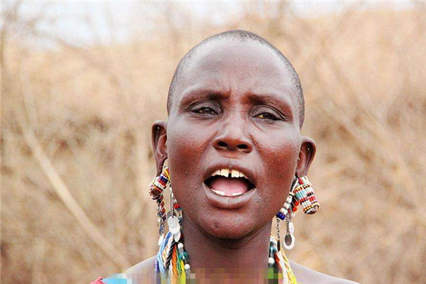 世界上门牙最大的人 来自加拿大的9岁男孩（长2.28cm）734 / 作者:UFO爱好者 / 帖子ID:90881