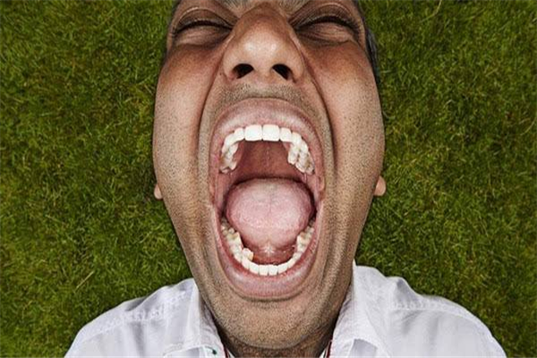 世界上门牙最大的人 来自加拿大的9岁男孩（长2.28cm）931 / 作者:UFO爱好者 / 帖子ID:90881