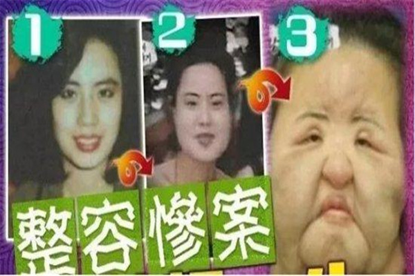 韩国电风扇大妈现状 因整容过度导致面目全非（已去世）972 / 作者:UFO爱好者 / 帖子ID:99591