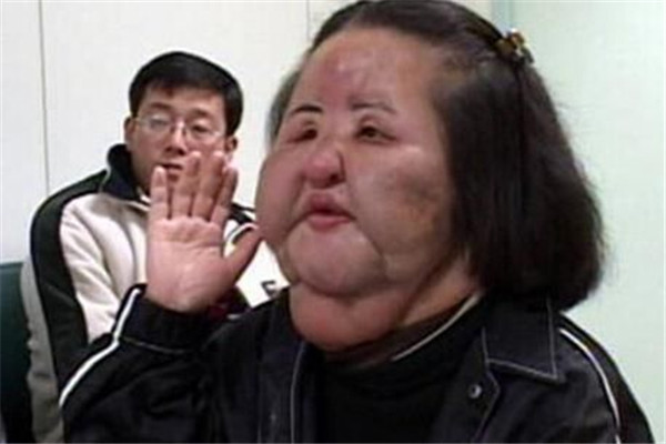 韩国电风扇大妈现状 因整容过度导致面目全非（已去世）264 / 作者:UFO爱好者 / 帖子ID:99591