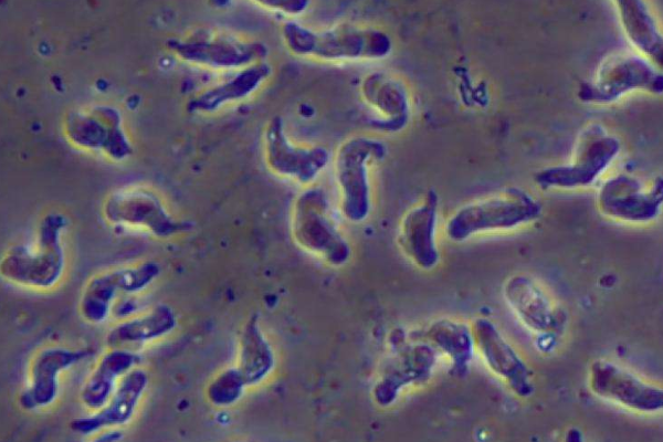 食脑虫会吃人脑吗 诱发脑膜炎潜伏期短(99%死亡率)380 / 作者:UFO爱好者 / 帖子ID:80388