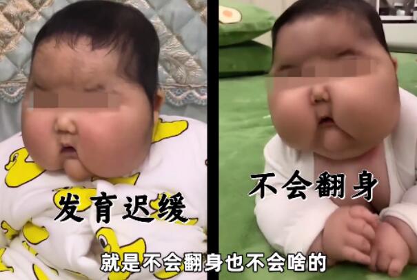 5个月大的女婴抹了婴儿霜后变“大头娃娃”，月胖3斤384 / 作者:UFO爱好者 / 帖子ID:76137