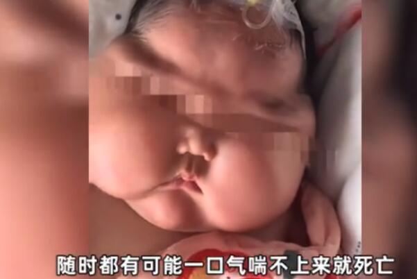 5个月大的女婴抹了婴儿霜后变“大头娃娃”，月胖3斤761 / 作者:UFO爱好者 / 帖子ID:76137
