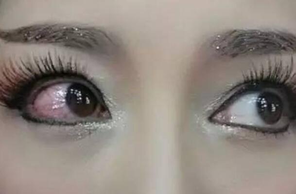 隐形眼镜戴久了有什么危害 可能会让眼睛抵抗力下降218 / 作者:UFO爱好者 / 帖子ID:71210