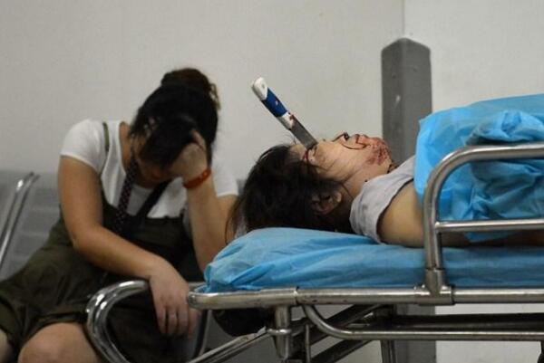 被刀插了为什么不能马上拔：会失血过多死亡（二次伤害）108 / 作者:UFO爱好者 / 帖子ID:69987
