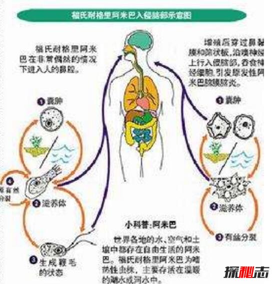 福氏耐格里变形虫真可怕，一步步慢慢吃掉你的大脑致死638 / 作者:UFO爱好者 / 帖子ID:106061
