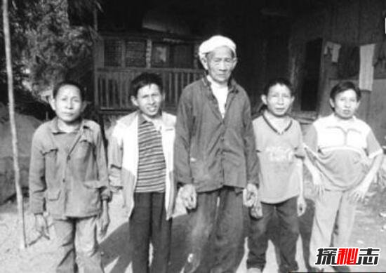 江苏矮人家族百年诅咒之谜，4代9人身高不足1.4/遗传疾病195 / 作者:UFO爱好者 / 帖子ID:99006