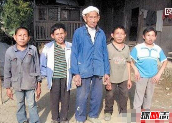 江苏矮人家族百年诅咒之谜，4代9人身高不足1.4/遗传疾病310 / 作者:UFO爱好者 / 帖子ID:99006