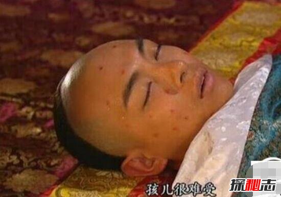 同治帝死因之谜，同治皇帝的真正死因(感染性病死亡/梅毒)387 / 作者:UFO爱好者 / 帖子ID:98604