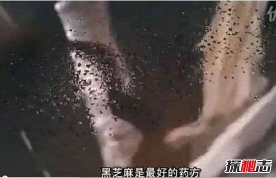 超恶心芝麻女孩的故事，芝麻镶进毛孔用牙签挑(图片/慎点)209 / 作者:UFO爱好者 / 帖子ID:105774