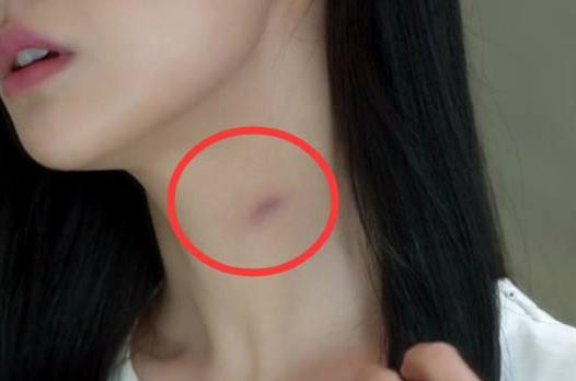 种草莓的梗是什么意思 种草莓技巧吻痕图片 草莓就是吻痕的意思759 / 作者:UFO爱好者 / 帖子ID:68842