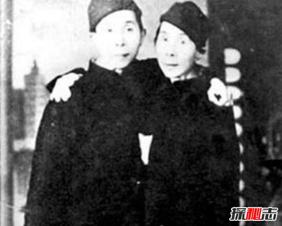 盘点全球最奇特连体人，连体双胞胎各自结婚生子生活幸福301 / 作者:UFO爱好者 / 帖子ID:106002