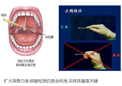 核酸检测新冠病毒的常用手段：口腔拭子、鼻腔拭子检测图示218 / 作者:UFO爱好者 / 帖子ID:70657