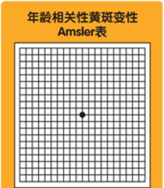 眼睛长黄斑别大意！延误治疗时机当心失明973 / 作者:UFO爱好者 / 帖子ID:72761