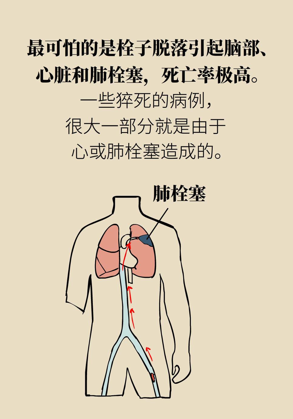 久坐最可怕的后果不是胖！不注意可能要命145 / 作者:UFO爱好者 / 帖子ID:71865